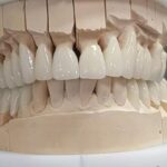 دندان پزشکی و دندان سازی