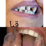 دندان پزشکی و دندان سازی
