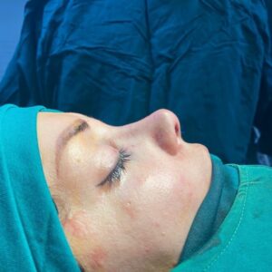 خدمات جراحی زیبایی بینی پلک گوش هایفو بوتاکس ژل