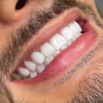 خدمات کامپوزیت دندان ایمپلنت دندان دست دندان