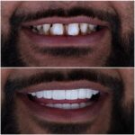 خدمات دندانپزشکی ایمپلنت دندان کامپوزیت دندان