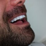 کامپوزیت دندان در نادری اهواز