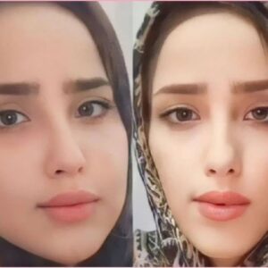 چاقی و تپلی صورت