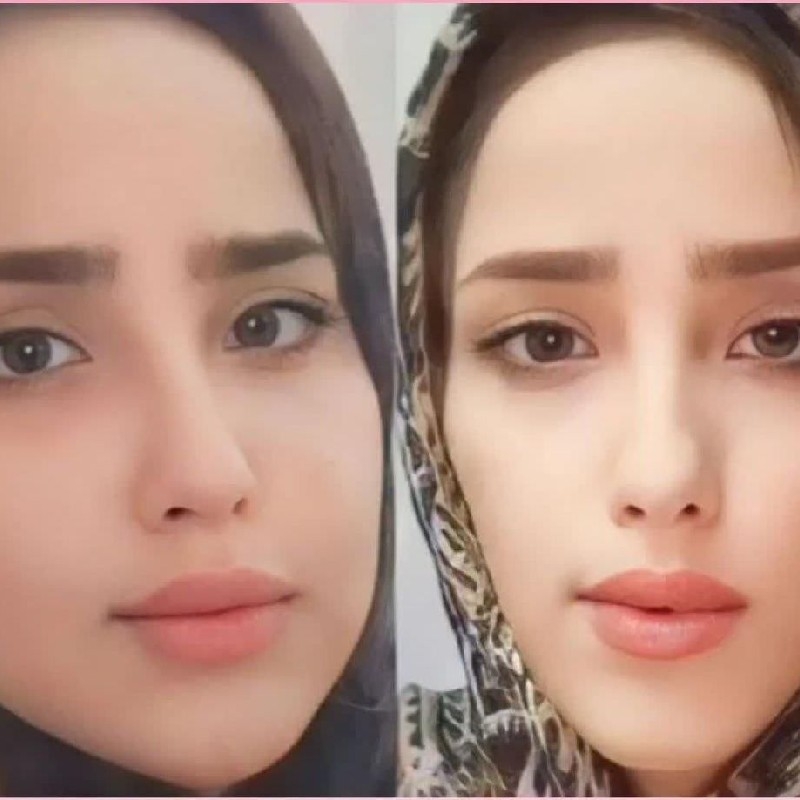 چاقی و تپلی صورت