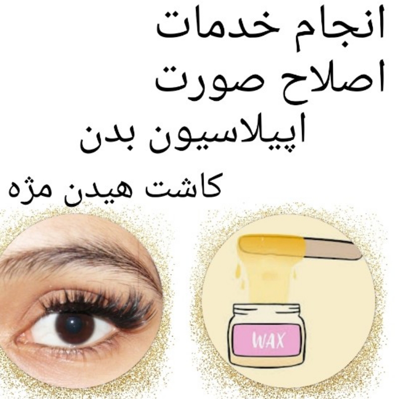 کاشت هیدن