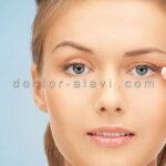 برداشتن خال با لیزر در شرق تهران